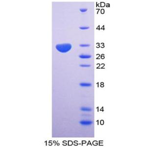 85kDa核孔蛋白(NUP85)重组蛋白,Recombinant Nucleoporin 85 (NUP85)