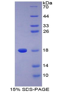 ⅡA组磷脂酶A2(PLA2G2A)重组蛋白,Recombinant Phospholipase A2, Group IIA (PLA2G2A)