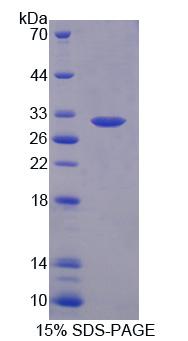 Ⅲ组磷脂酶A2(PLA2G3)重组蛋白,Recombinant Phospholipase A2, Group III (PLA2G3)