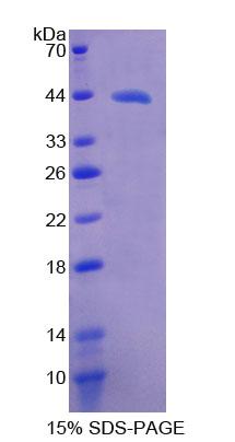 ⅣD组磷脂酶A2(PLA2G4D)重组蛋白,Recombinant Phospholipase A2, Group IVD (PLA2G4D)