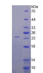 ⅩⅥ型胶原(COL16)重组蛋白,Recombinant Collagen Type XVI (COL16)