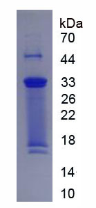 Ⅹ型胶原(COL10)重组蛋白,Recombinant Collagen Type X (COL10)