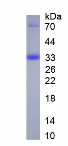 Ⅻ型膠原(COL12)重組蛋白,Recombinant Collagen Type XII (COL12)