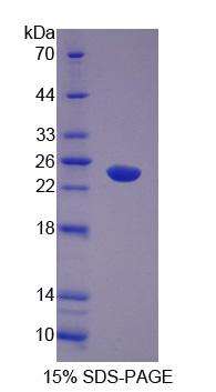 Abl交互子1(ABI1)重組蛋白,Recombinant Abl Interactor 1 (ABI1)