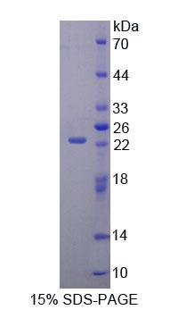 AMPA离子能谷氨酸受体3(GRIA3)重组蛋白,Recombinant Glutamate Receptor, Ionotropic, AMPA 3 (GRIA3)