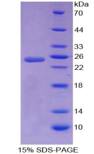 Apobec 1偶聯(lián)因子(ACF)重組蛋白,Recombinant Apobec 1 Complementation Factor (ACF)