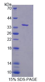 Asc型氨基酸转运蛋白1(ASC1)重组蛋白,Recombinant Asc Type Amino Acid Transporter 1 (ASC1)