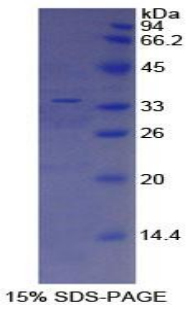 ATP结合盒转运蛋白A3(ABCA3)重组蛋白,Recombinant ATP Binding Cassette Transporter A3 (ABCA3)