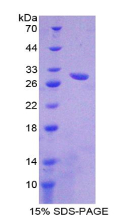 ATP结合盒转运蛋白B11(ABCB11)重组蛋白,Recombinant ATP Binding Cassette Transporter B11 (ABCB11)