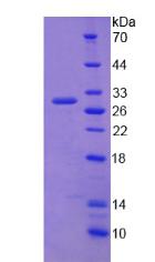 ATP结合盒转运蛋白C2(ABCC2)重组蛋白,Recombinant ATP Binding Cassette Transporter C2 (ABCC2)