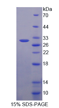 ATP结合盒转运蛋白C3(ABCC3)重组蛋白,Recombinant ATP Binding Cassette Transporter C3 (ABCC3)