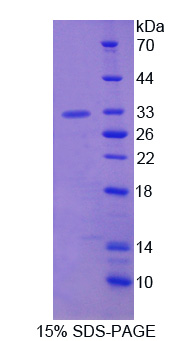 ATP结合盒转运蛋白C8(ABCC8)重组蛋白,Recombinant ATP Binding Cassette Transporter C8 (ABCC8)