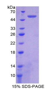 ATP酶蛋白酶体26S亚基1(PSMC1)重组蛋白,Recombinant Proteasome 26S Subunit, ATPase 1 (PSMC1)