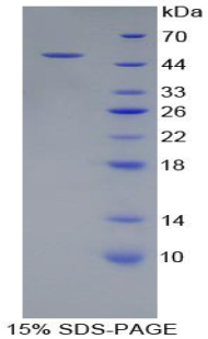 ATP酶蛋白酶体26S亚基2(PSMC2)重组蛋白,Recombinant Proteasome 26S Subunit, ATPase 2 (PSMC2)