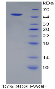 ATP酶蛋白酶體26S亞基3(PSMC3)重組蛋白,Recombinant Proteasome 26S Subunit, ATPase 3 (PSMC3)