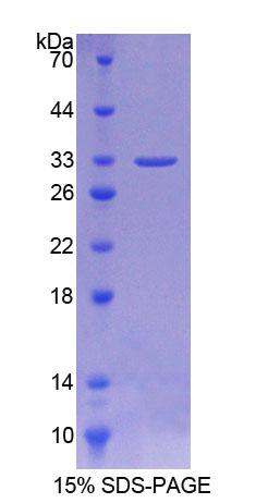 Aurora激酶C(AURKC)重組蛋白,Recombinant Aurora Kinase C (AURKC)