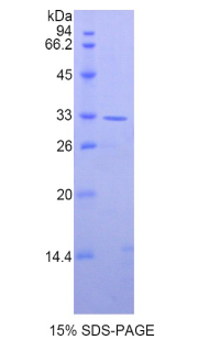 Axis抑制蛋白2(AXIN2)重组蛋白,Recombinant Axis Inhibition Protein 2 (AXIN2)