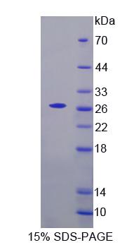 AXL受體酪氨酸激酶(AXL)重組蛋白,Recombinant AXL Receptor Tyrosine Kinase (AXL)