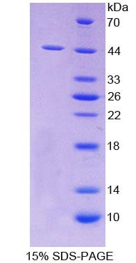 A类清道夫受体5(SCARA5)重组蛋白,Recombinant Scavenger Receptor Class A Member 5 (SCARA5)