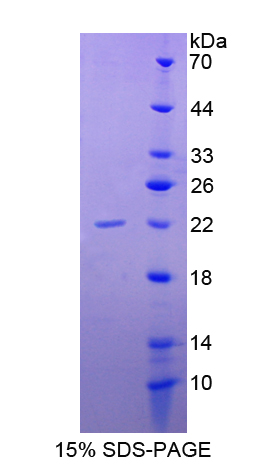 Bcl2关联死亡启动子(BAD)重组蛋白,Recombinant Bcl2 Associated Death Promoter (BAD)