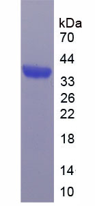 Bcl2相关髓细胞白血病序列1(MCL1)重组蛋白,Recombinant Induced Myeloid Leukemia Cell Differentiation Protein Mcl-1 (MCL1)