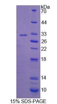 Bcl6辅抑制因子(BCOR)重组蛋白,Recombinant Bcl6 Corepressor (BCOR)