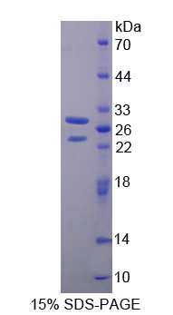 BMX非受体酪氨酸激酶(BMX)重组蛋白,Recombinant BMX Non Receptor Tyrosine Kinase (BMX)