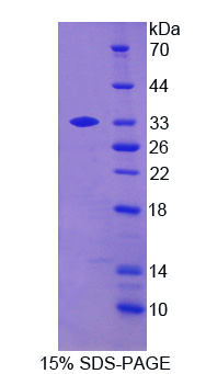 B-淋巴酪氨酸激酶(BLK)重组蛋白,Recombinant B-LymphoidTyrosine Kinase (BLK)