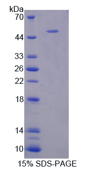 B-淋巴细胞激活抗原B7-1(LAB7-1)重组蛋白,Recombinant B-Lymphocyte Activation Antigen B7-1 (LAB7-1)
