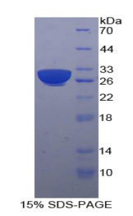 B-細胞連接蛋白(BLNK)重組蛋白,Recombinant B-Cell Linker Protein (BLNK)