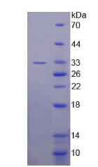 B-細(xì)胞淋巴瘤因子11A(Bcl11A)重組蛋白,Recombinant B-Cell CLL/Lymphoma 11A (Bcl11