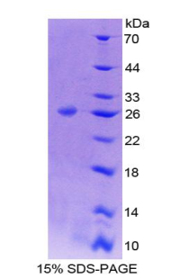 B-细胞淋巴瘤因子9(Bcl9)重组蛋白,Recombinant B-Cell CLL/Lymphoma 9 (Bcl9)