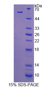 C1q肿瘤坏死因子相关蛋白1(C1QTNF1)重组蛋白,Recombinant C1q And Tumor Necrosis Factor Related Protein 1 (C1QTNF1)