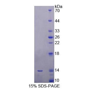 9kDa信号识别颗粒(SRP9)重组蛋白