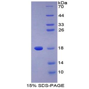 ⅡA组磷脂酶A2(PLA2G2A)重组蛋白
