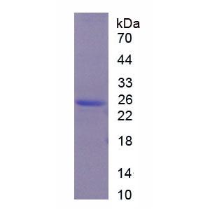 ⅩⅨ型胶原(COL19)重组蛋白,Recombinant Collagen Type XIX (COL19)