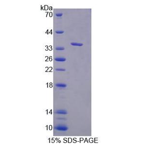 Asc型氨基酸转运蛋白1(ASC1)重组蛋白