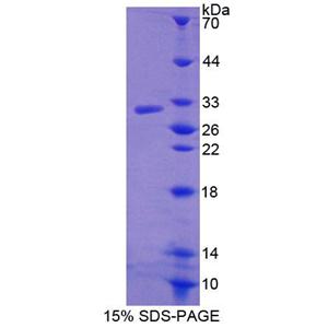 ATP结合盒转运蛋白C12(ABCC12)重组蛋白