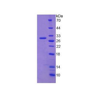 ATP结合盒转运蛋白C2(ABCC2)重组蛋白,Recombinant ATP Binding Cassette Transporter C2 (ABCC2)