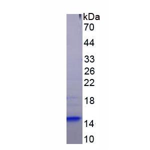 Bcl2关联永生基因3(BAG3)重组蛋白