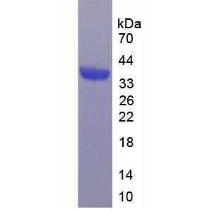 Bcl2相关髓细胞白血病序列1(MCL1)重组蛋白