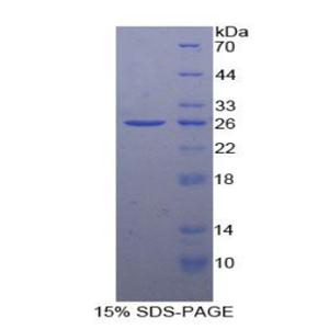 BH3相互作用域死亡激动剂(Bid)重组蛋白