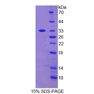 B-淋巴酪氨酸激酶(BLK)重组蛋白,Recombinant B-LymphoidTyrosine Kinase (BLK)