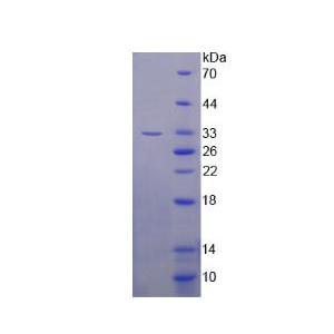 B-细胞淋巴瘤因子11A(Bcl11A)重组蛋白