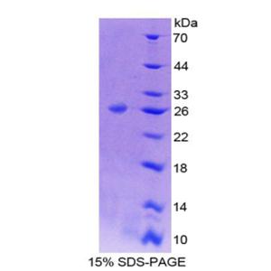 B-细胞淋巴瘤因子9(Bcl9)重组蛋白,Recombinant B-Cell CLL/Lymphoma 9 (Bcl9)