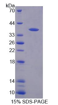 C1q肿瘤坏死因子相关蛋白9(C1QTNF9)重组蛋白,Recombinant C1q And Tumor Necrosis Factor Related Protein 9 (C1QTNF9)