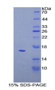 CD160分子(CD160)重組蛋白,Recombinant Cluster Of Differentiation 160 (CD160