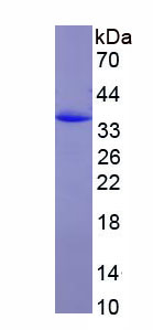 CD163分子(CD163)重組蛋白,Recombinant Cluster Of Differentiation (CD163)