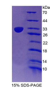 CD1e分子(CD1e)重组蛋白,Recombinant Cluster Of Differentiation 1e (CD1e)