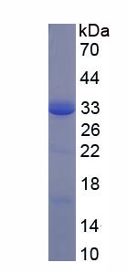 CD200受体1(CD200R1)重组蛋白,Recombinant CD200 Receptor 1 (CD200R1)